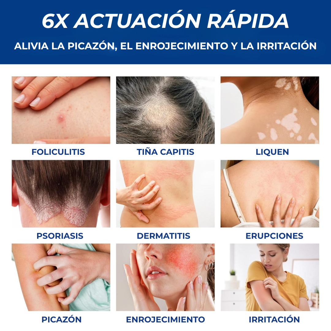 AVERA™ Crema Intensiva para Foliculitis